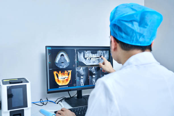 Best Knocked-Out Tooth (Avulsed Tooth) Treatment in Sugarcreek, OH